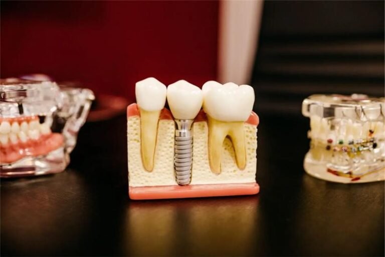 Peach Media Company | How Dental Implant Lead Generation Drives Implant Consultations